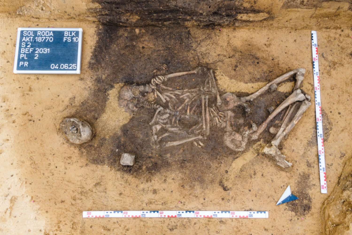 クラウシュビッツで見つかった女性の墓からは動物の歯も出土した。Photo: Courtesy of State Office for Heritage Management and Archaeology Saxony-Anhalt